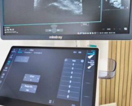 Ecografía musculoesquelética para fisioterapia en Clínica Lyceum Majadahonda